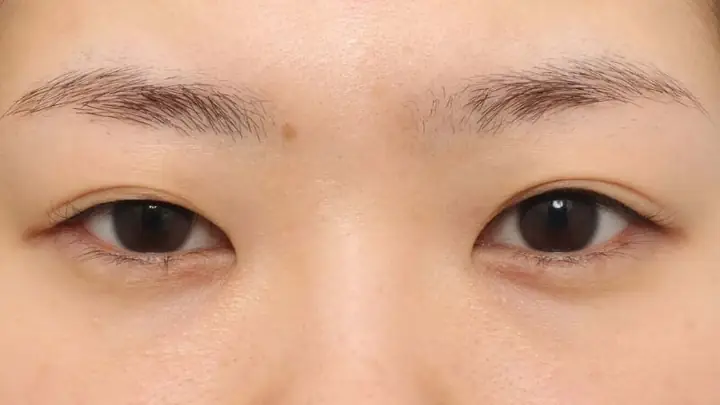 Người Mắt To Mắt Nhỏ Tướng Số