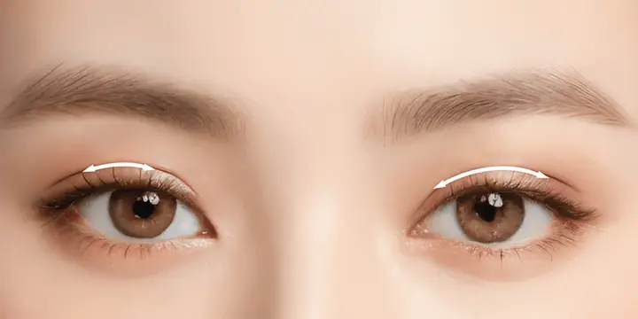 Nhấn Mí Có Ảnh Hưởng Đến Tướng Số