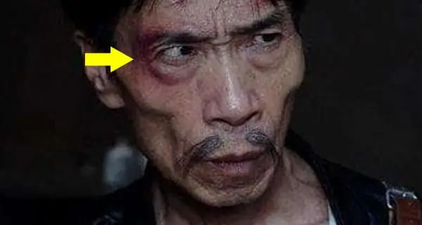 Nhân Tướng Mắt Sâu