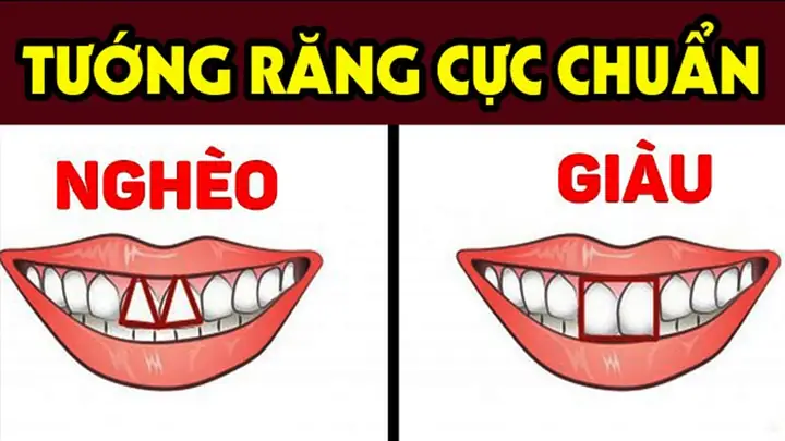 Nhìn Tướng Mặt Biết Nghèo Hay Giàu