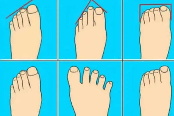 Nhìn Tướng Mặt Biết Nghèo Hay Giàu