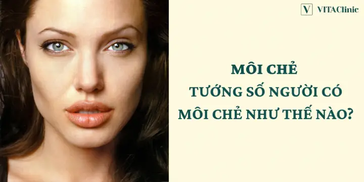 Những Đại Gia Có Tướng Môi Chẻ