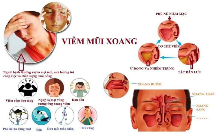 Những Thói Quen Xấu Về Mặt Tướng Số