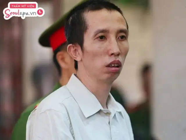 Những Tướng Mặt Không Tốt Đen Đủi