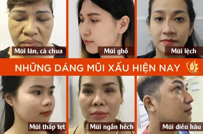 Những Tướng Mũi Xấu