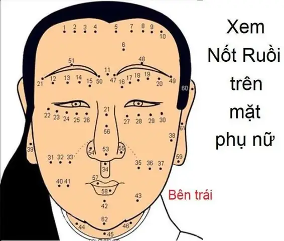 Nốt Ruồi Tướng Số Nữ