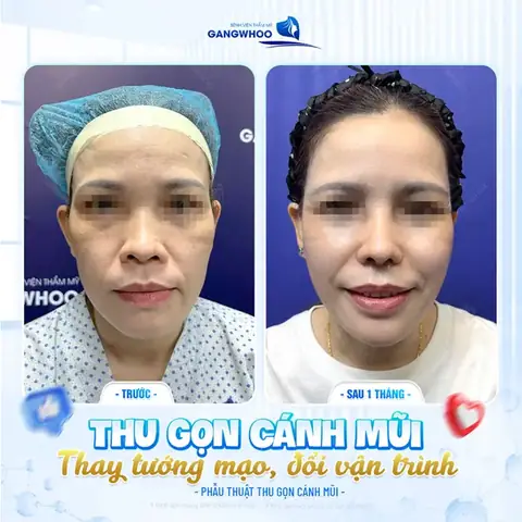 Phẫu Thuật Thẫm Mỹ Mặt Có Thay Đổi Tướng Số