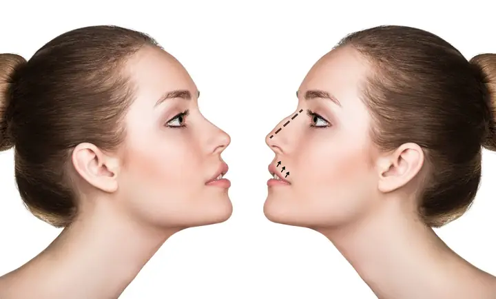 Phụ Nữ Có Tướng Mũi Diều Hâu