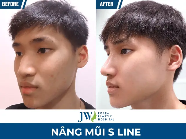 Phụ Nữ Có Tướng Mũi Diều Hâu
