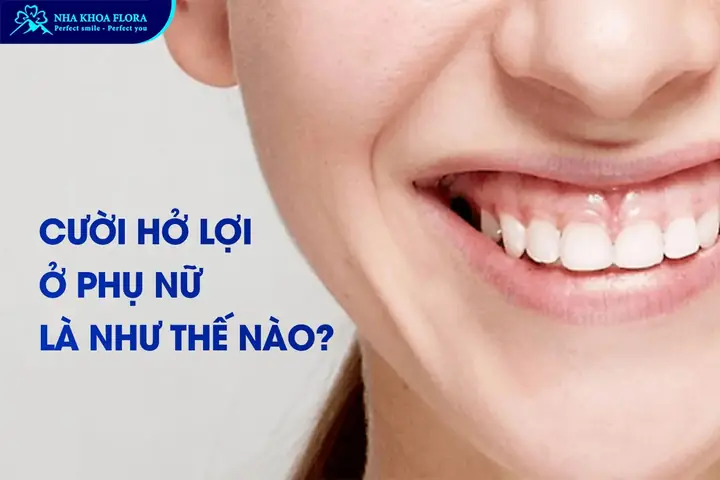 Phụ Nữ Cười Hở Lợi Tướng Số