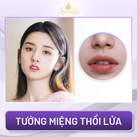 Phụ Nữ Tướng Miệng Nhỏ