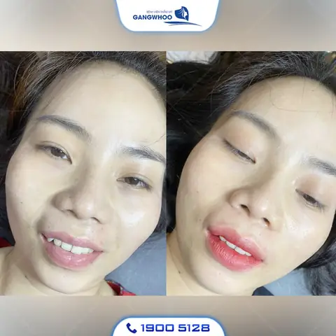 Phun Môi Có Ảnh Hưởng Đến Tướng Số Không