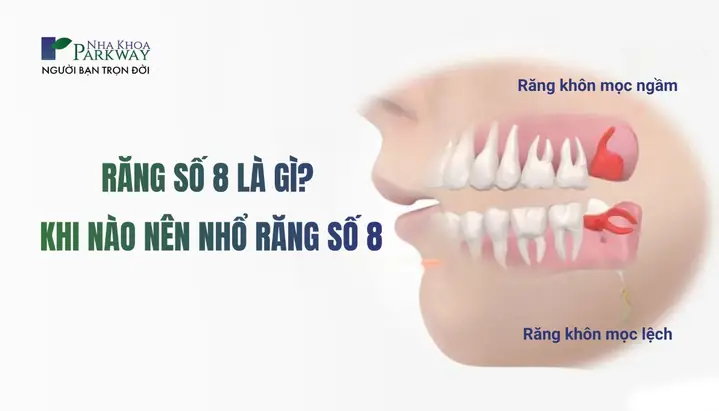 Răng Mọc So Le Tướng Số Răng Mọc So Le Tướng Số