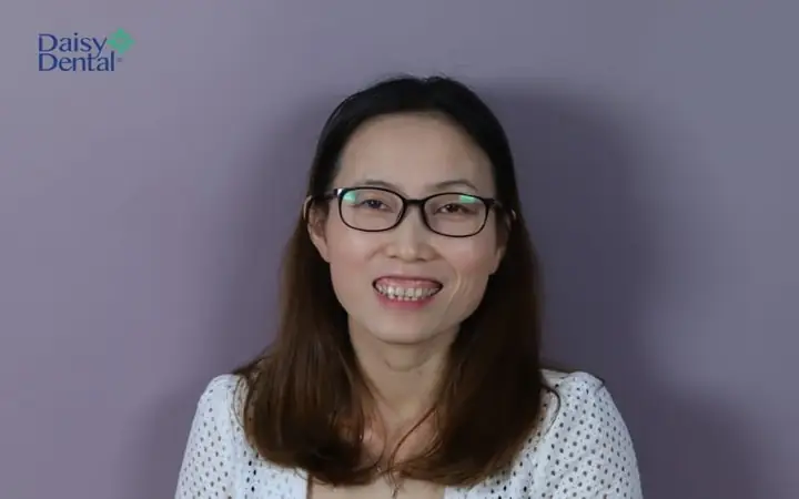 Răng Ngắn Cười Hở Lợi Tướng Số
