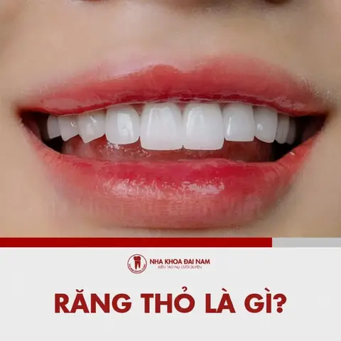 Răng Thỏ Tướng Số Răng Thỏ Tướng Số