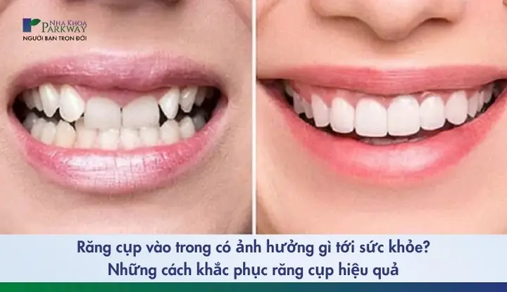 Răng Thụt Vào Trong Tướng Số Răng Thụt Vào Trong Tướng Số