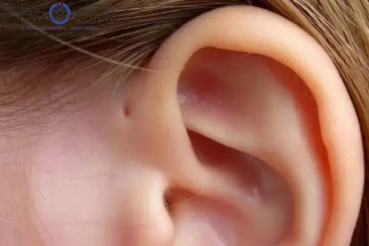 Rò Luân Nhĩ Tướng Số Rò Luân Nhĩ Tướng Số