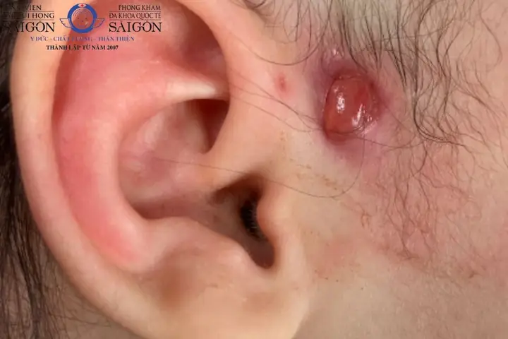 Rò Luân Nhĩ Tướng Số Rò Luân Nhĩ Tướng Số