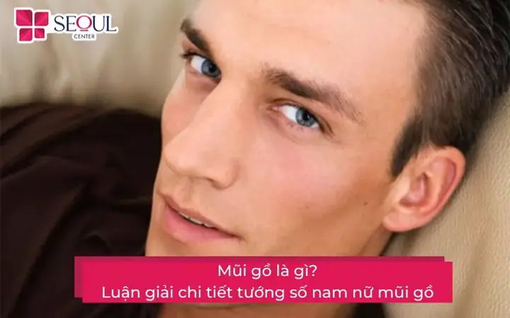 Sống Mũi Bị Gồ Tướng Số