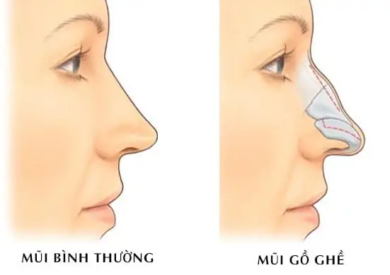 Sống Mũi Cao Tướng Số