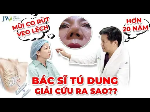 Sửa Mũi Theo Tướng Số