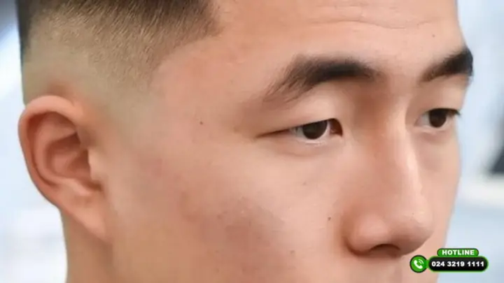 Sửa Tướng Chân Mày