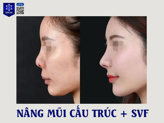 Tại Sao Sửa Tướng Mặt Lại Sứa Số Mệnh