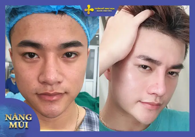 Tại Sao Sửa Tướng Mặt Lại Sứa Số Mệnh