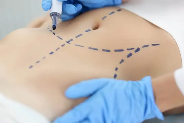 Tướng Bụng Làm Quan