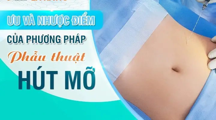 Tướng Bụng Làm Quan Tướng Bụng Làm Quan