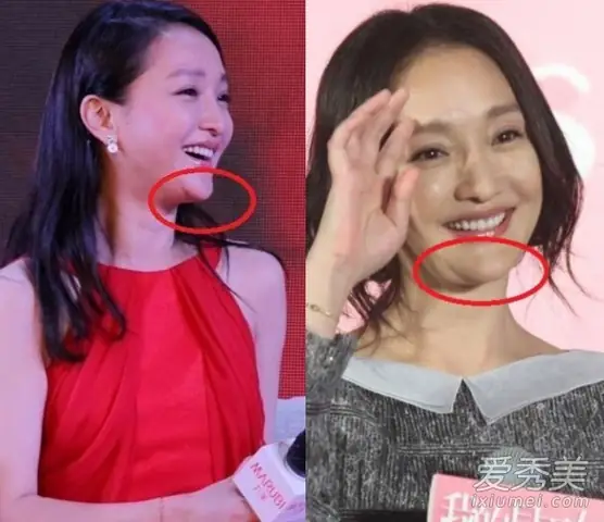 Tướng Cằm Chìa Ra