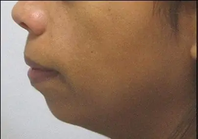 Tướng Cằm Đàn Ông Tướng Cằm Đàn Ông
