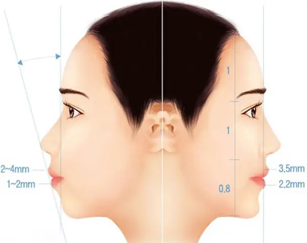 Tướng Cằm Nhỏ Nhọn