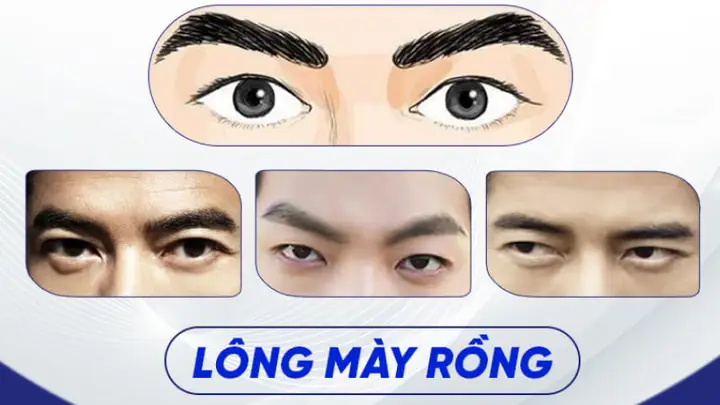 Tướng Chân Mày Đàn Ông Tot