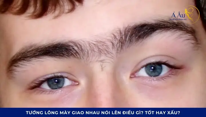 Tướng Chân Mày Dính Nhau