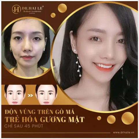 Tướng Gò Má Đầy Đặn Tướng Gò Má Đầy Đặn