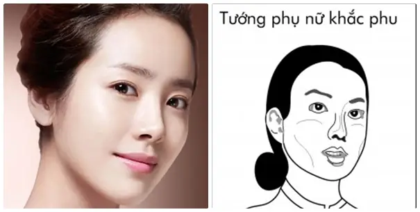 Tướng Gò Má Nhô Quá Cao