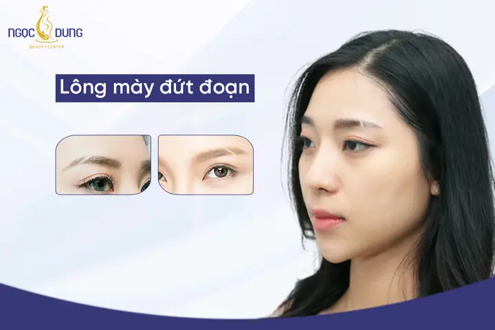 Tướng Lông Mày Bị Đứt Đoạn Tướng Lông Mày Bị Đứt Đoạn