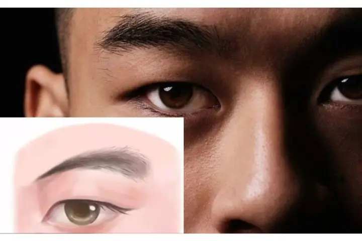 Tướng Lông Mày Chổi Xể
