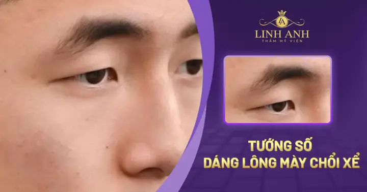 Tướng Lông Mày Chổi Xể Sát Thủ