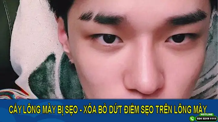 Tướng Lông Mày Có Sẹo Tướng Lông Mày Có Sẹo