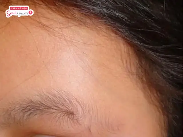 Tướng Lông Mày Có Xoáy Tướng Lông Mày Có Xoáy