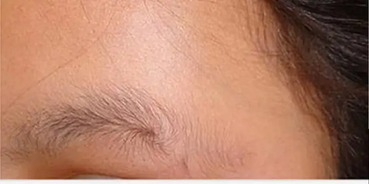 Tướng Lông Mày Có Xoáy Ở Đuôi