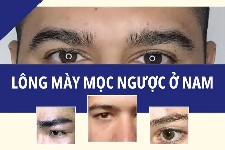 Tướng Lông Mày Dựng Đứng