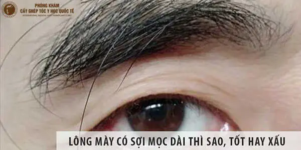 Tướng Lông Mày Mọc Dài Tướng Lông Mày Mọc Dài