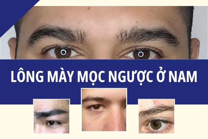 Tướng Lông Mày Mọc Ngược