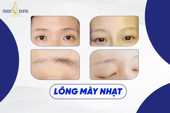 Tướng Lông Mày Nhạt Tướng Lông Mày Nhạt