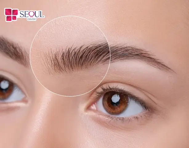 Tướng Lông Mày Quặt Ngược Lên Trán Tướng Lông Mày Quặt Ngược Lên Trán