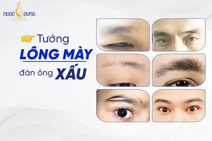 Tướng Lông Mày Thưa