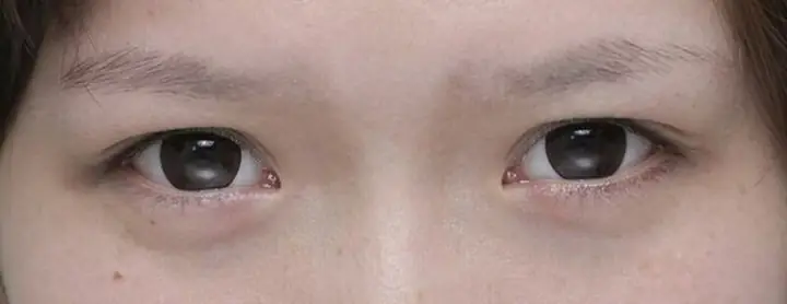 Tướng Lông Mày Thưa Nhạt